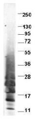 NBP1-42776 - Interleukin-13 / IL13