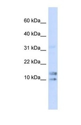 NBP1-58976 - Interleukin-15 / IL15