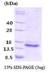 NBC1-22943 - Interleukin-15 / IL15