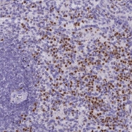 NBP1-83113 - Interleukin-17B / IL17B