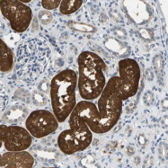 NBP1-85450 - Interleukin-17B / IL17B