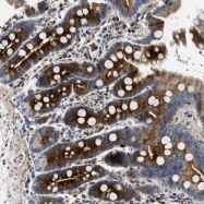 NBP1-83112 - IL17RC