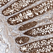 NBP1-83894 - IL1F5 / IL1L1