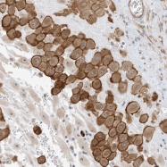 NBP1-83892 - IL1F8 / IL1H2