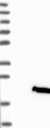 NBP1-83892 - IL1F8 / IL1H2