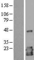 NBL1-11933 - IL1RA antagonist Lysate