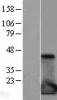 NBL1-11934 - IL1RA antagonist Lysate