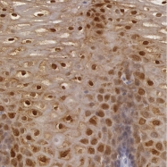 NBP1-81616 - IL1RN / IL1RA