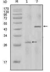 NBP1-47390 - Interleukin-2 / IL2