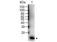 NBP1-77570 - Interleukin-2 / IL2