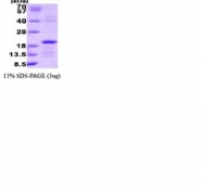 NBC1-22605 - Interleukin-2 / IL2