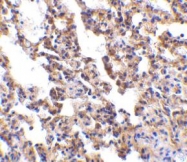 NBP1-76739 - Interleukin-21 receptor / IL21R