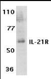 NBP1-76739 - Interleukin-21 receptor / IL21R