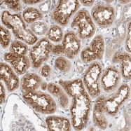 NBP1-85455 - IL22RA2