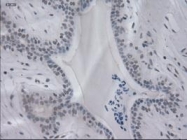NBP1-47806 - Interleukin-3 / IL3