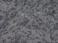 NBP1-47806 - Interleukin-3 / IL3