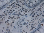 NBP1-47806 - Interleukin-3 / IL3