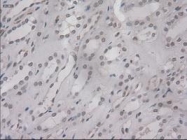NBP1-47806 - Interleukin-3 / IL3