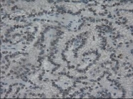 NBP1-47806 - Interleukin-3 / IL3