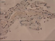 NBP1-47806 - Interleukin-3 / IL3
