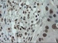 NBP1-47806 - Interleukin-3 / IL3