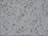 NBP1-47806 - Interleukin-3 / IL3