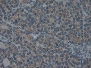 NBP1-47806 - Interleukin-3 / IL3