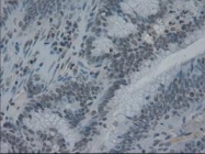 NBP1-47806 - Interleukin-3 / IL3