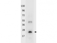 NBP1-42755 - Interleukin-32 / IL32