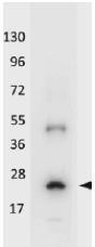 NBP1-42756 - Interleukin-32 / IL32