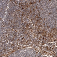 NBP1-82560 - Interleukin-32 / IL32