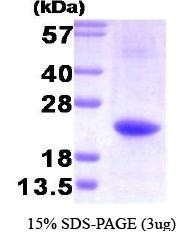 NBC1-25853 - Interleukin-32 / IL32