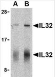 NBP1-76684 - Interleukin-32 / IL32