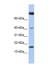 NBP1-59332 - Interleukin-4 / IL4