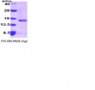 NBC1-22613 - Interleukin-4 / IL4