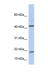 NBP1-59334 - Interleukin-9 / IL9