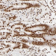 NBP1-85117 - ILKAP