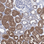 NBP1-86352 - Inositol monophosphatase 2 / IMPA2
