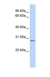 NBP1-54964 - Inositol monophosphatase 2 / IMPA2