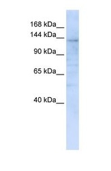 NBP1-62656 - IMPG2 / IPM200