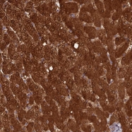 NBP1-90960 - INCA1 / HSD45
