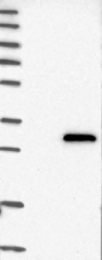 NBP1-88414 - INF2
