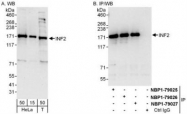 NBP1-79025 - INF2