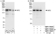 NBP1-79027 - INF2