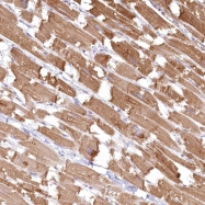 NBP1-85883 - INPP4B