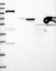 NBP1-85883 - INPP4B