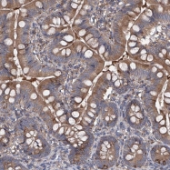 NBP1-89439 - INPP5B / 5PTase 2