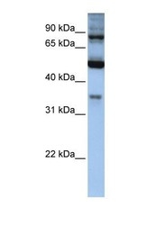 NBP1-54719 - INPP5B / 5PTase 2