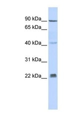 NBP1-59687 - INSIG2