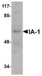 NBP1-76307 - INSM1 / IA1